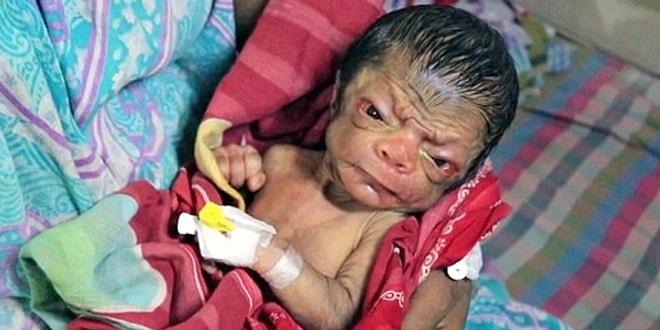 Yeni Doğmasına Rağmen 80 Yaşında Gibi Görünen, Görenleri Hayrete Düşüren Bebek