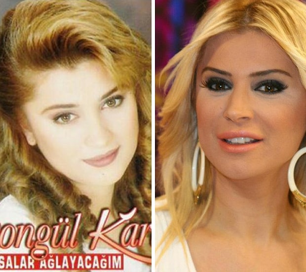 Estetik Operasyonlardan Sonra Adeta Baska Bir Insana Donusen 19 Turk Unlu Estetik Operasyonlardan Sonra Adeta Baska Bir Insana Donusen 19 Turk Unlu