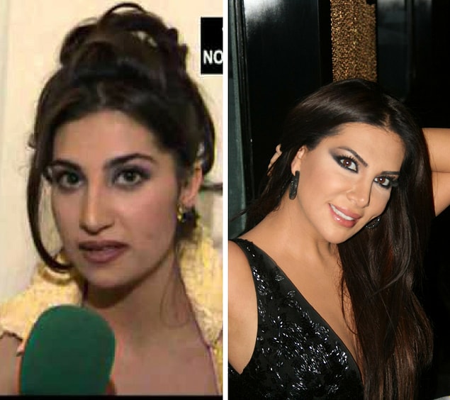 17. Ebru Yaşar Estetiksiz vs Estetikli