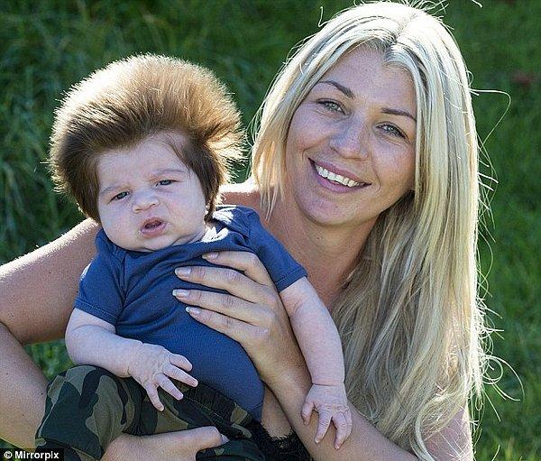 32 yaşındaki kuaför annesi Chelsea Noon: "Bir sürü saçla doğdu. İlk banyosunu yaptırınca ancak ne kadar çok olduğunu fark ettim." dedi.