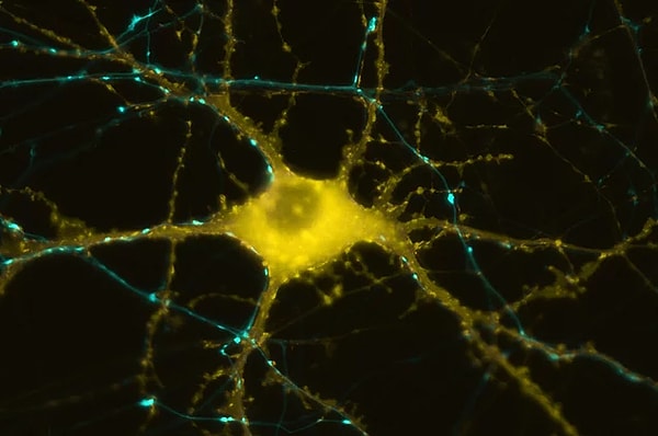 9. Во время влюбленности нервные клетки восстанавливаются намного быстрее и почти не разрушаются