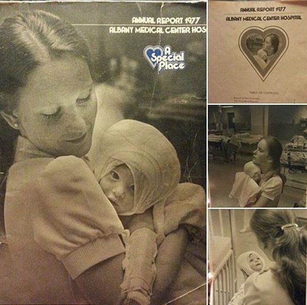 3. По мере того, как Аманда взрослела, другие дети постоянно высмеивали ее шрамы и ожоги, от чего девочка сильно переживала.