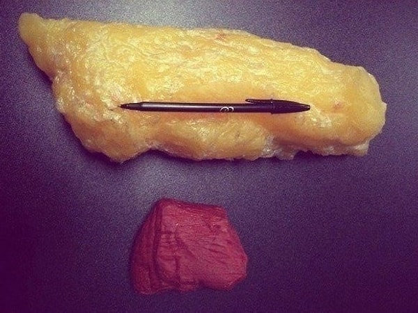 17. Так выглядят 1.5 кг жира и 1.5 кг мышц.