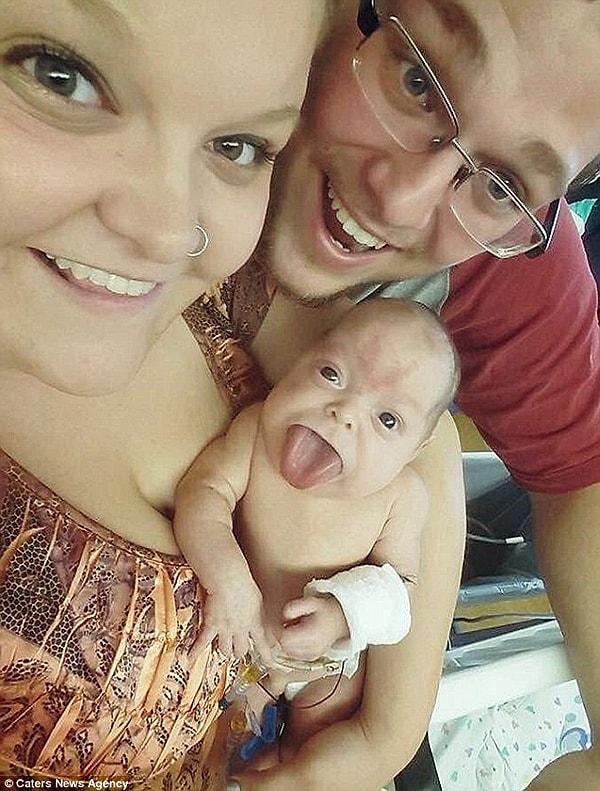 Doktorların da desteğiyle annesi Madison Kienow ve babası Shannon Morrison-Johnson ameliyatla dilinin kesilmesinin onun için en iyisinin olacağına karar verdiler.
