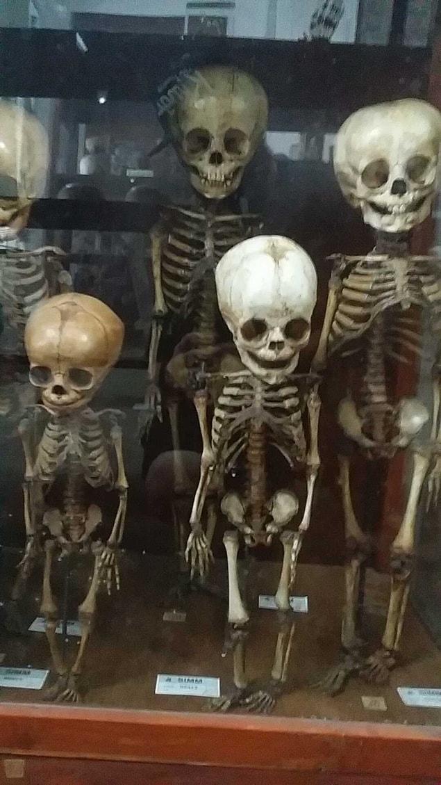 7. Childrens' skeletons