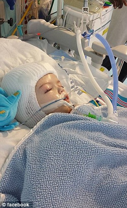 13 aylık kardeşler Anias ve Jadon McDonald perşembe günü geçirdikleri kritik ameliyatın ardından New York'taki Montefiore Hastanesi'nde halen gözetim altında tutuluyorlar.