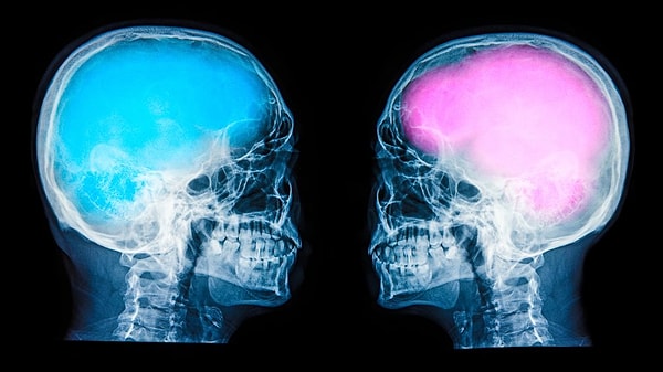 1. Исследовав 1400 реципиентов, было выяснено, что 0% людей имеет «полностью женский» или «полностью мужской» мозг.
