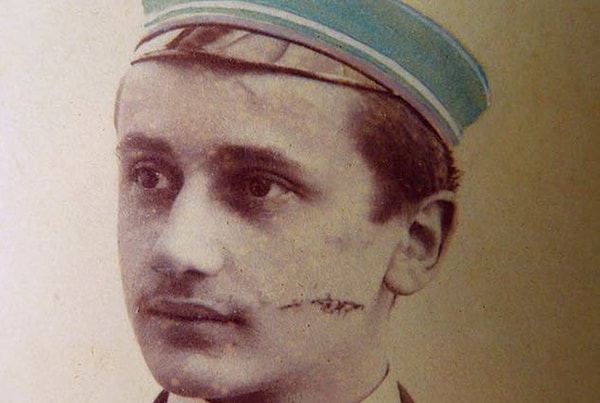 6. Глубокий шрам на лице