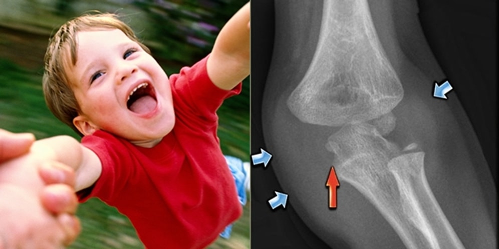 Hangimiz Yapmadık ki? Çocukları Kollarından Tutarak Döndürmek Zararlı mı?