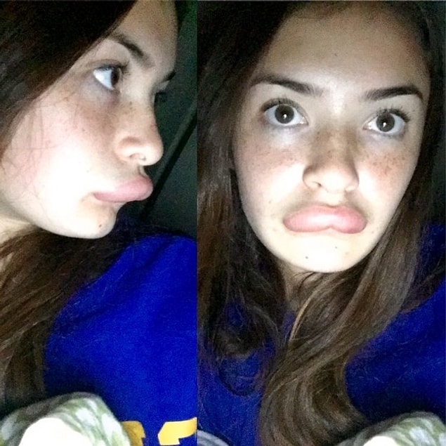 9. This girl who turned into something between Donald Duck and Homer Simpson.