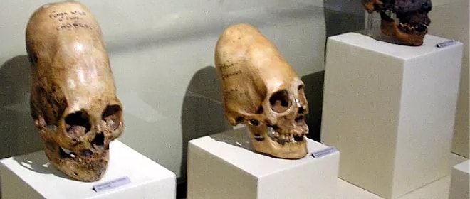 10 древних черепов, деформированных по моде