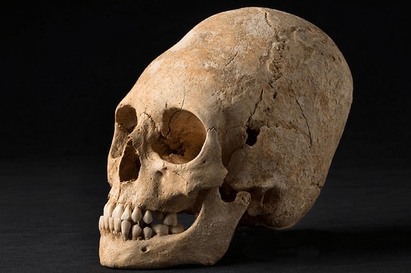 7. Эльзасская аристократка