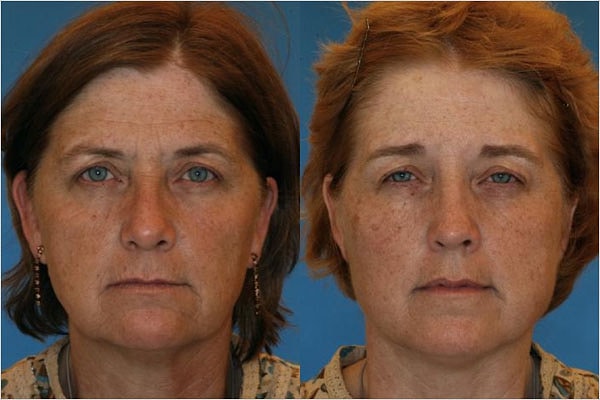 5. Женщина слева или справа?