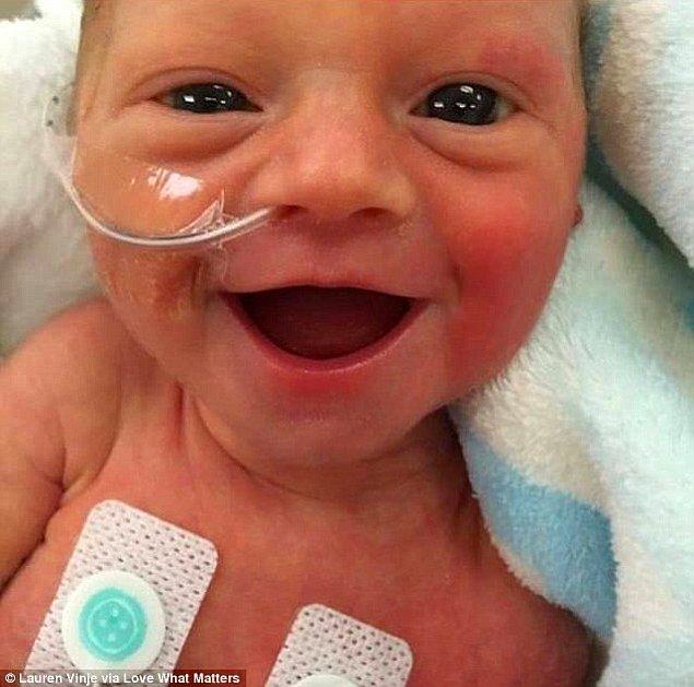 Prematüre bebeğin gülerken çekilmiş fotoğrafı sosyal medyada virüs gibi yayıldı. Bebeğin gülüşü, gören herkesin de gülmesini sağladı.