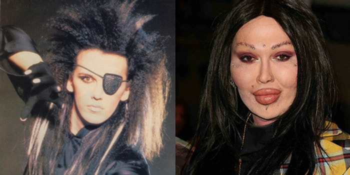 Dead Or Alive Grubuyla 80'lere Damga Vuran Pete Burns Hayatını Kaybetti