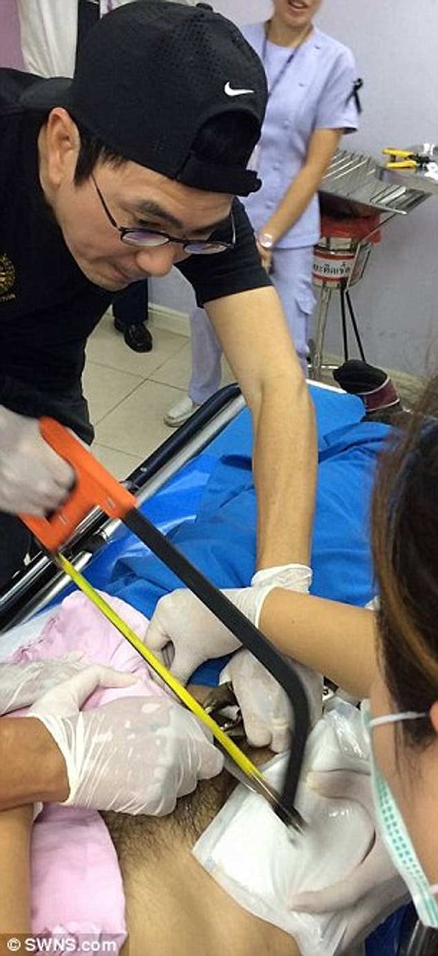 Yüzü fotoğraflara yansımayan orta yaşlı beyefendi kullandığı seks oyuncağını penisinden çıkaramayınca hastaneye geldi ancak...