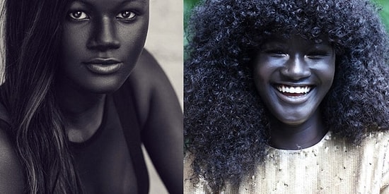 Melanin Tanrıçası: Çocukken Ten Rengiyle Dalga Geçilen Model Şimdi Fırtınalar Estiriyor!