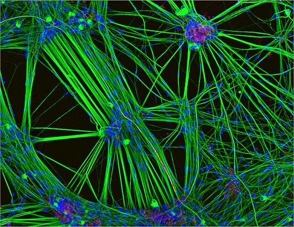 3. Üçüncü sırada Rebecca Nutbrown'un çektiği deri hücrelerinden türeyen nöronlar.