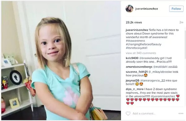 10. Каждый год во время месяца осведомленности о синдроме Дауна Дженнифер пытается высказаться за своих детей.