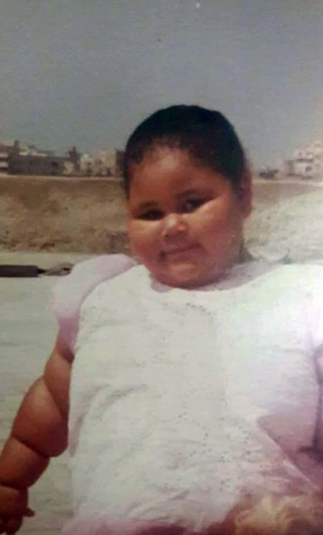Yaklaşık 5 kilo olarak doğan Iman, küçük bir çocukken de kilosundan dolayı yürümekte zorlanıyordu.