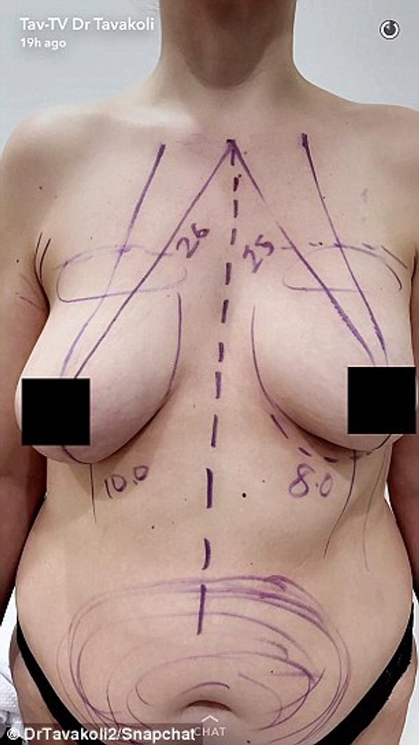 Разумеется, он просит у них разрешение на такого рода публикации. Обычно около 50% клиенток отвечают на просьбу положительно.