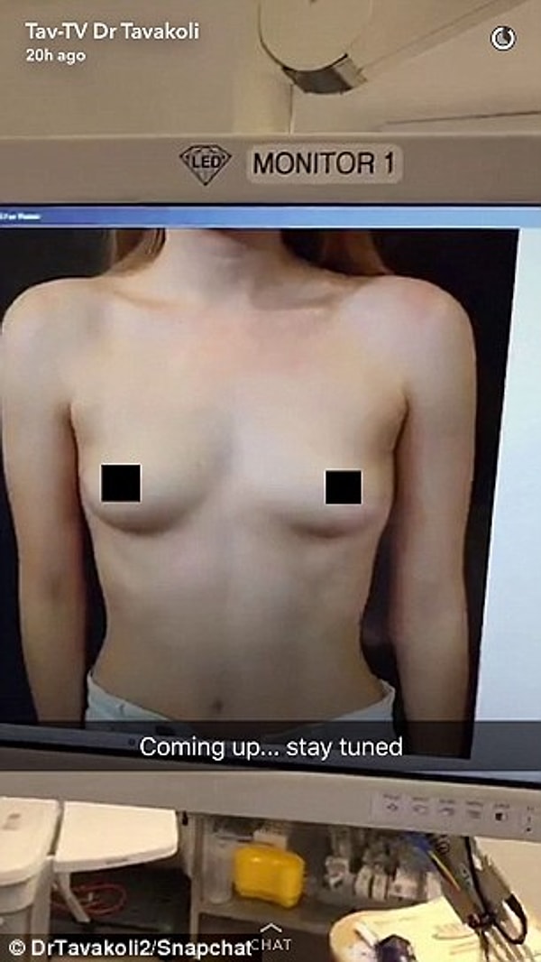 Можно сказать, что Tavakoli, опубликовавший первое видео 7 месяцев назад, стал родоначальником этого тренда.