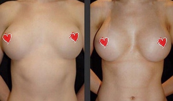 Клиенты клиники в случае согласия на съемку подписывают соответствующую форму.