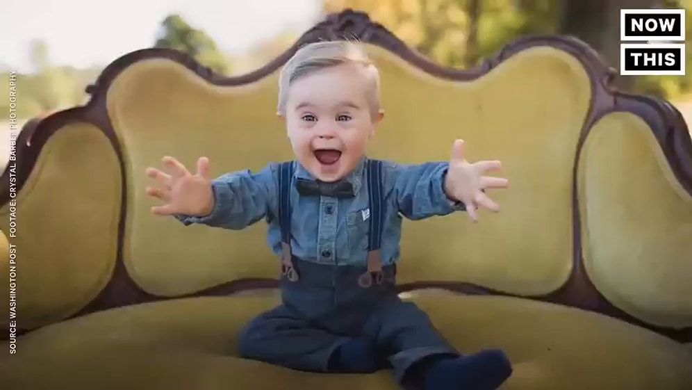 Малыш с синдромом Дауна стал звездой соцсетей