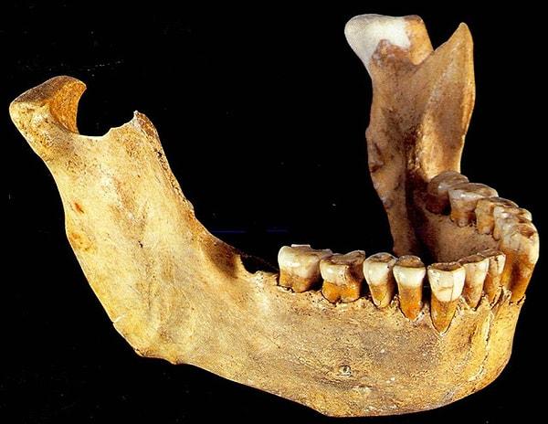 4. Yirmilik dişlerin bulunduğu boşluk