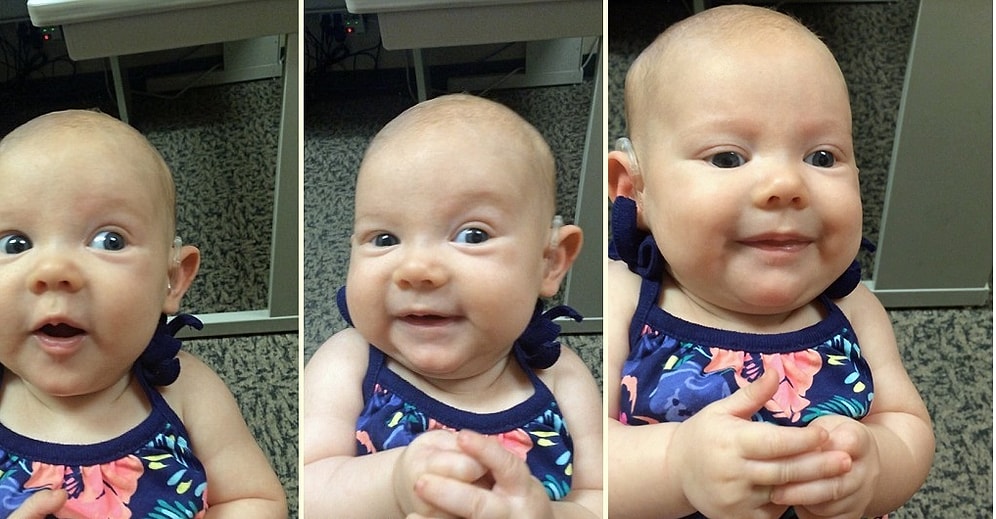 İşitme Engelli Bebeğin İlk Kez Annesinin Sesini Duyduğu O An