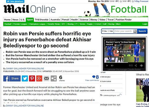Mail Online: "Van Persie gözünden korkunç bir şekilde yaralandı"
