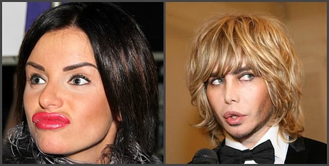 10 российских знаменитостей, которые пожалели о неудачной пластике