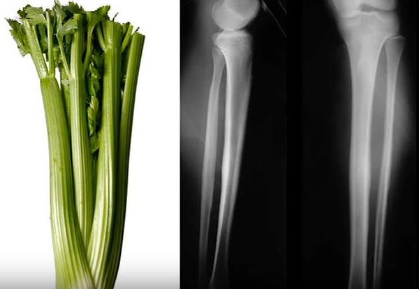 2. сельдерей = кости и суставы