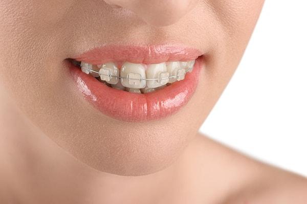 13. Tel dişlerinizi mükemmel hale getirir.