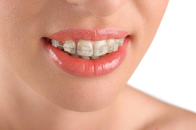 14. Tel dişlerinizi mükemmel hale getirir.