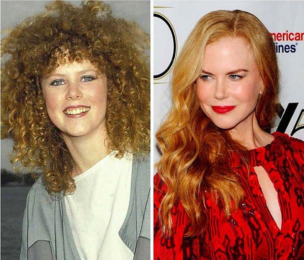 1. Nicole Kidman, 1983