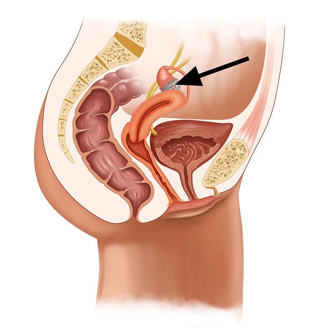 6. Kadınların üreme sistemine geldik. Okla gösterilen şey nedir?