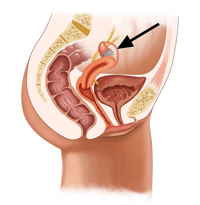 7. Kadınlarla devam ediyoruz. Sıradaki nedir?