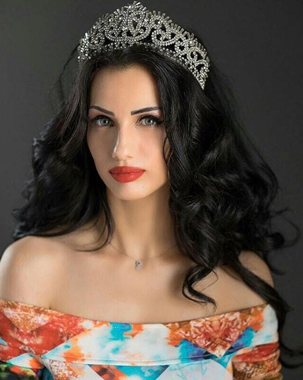 Miss Arab World güzellik yarışması birinciliği olan İmane Elbani Ortadoğu’da tanınan bir yıldız.