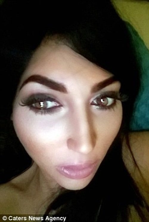 Yarı zamanlı şekilde bir resepsiyonist olarak çalışan Kim, yüzünde herhangi bir estetik olmadığını söylediğinde ise ona yöneltilen eleştiriler daha da sertleşiyormuş.
