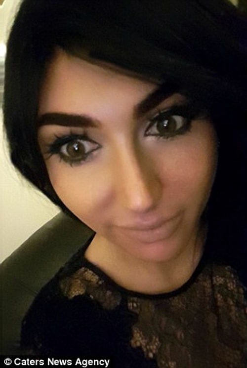 Yarı zamanlı şekilde bir resepsiyonist olarak çalışan Kim, yüzünde herhangi bir estetik olmadığını söylediğinde ise ona yöneltilen eleştiriler daha da sertleşiyormuş.
