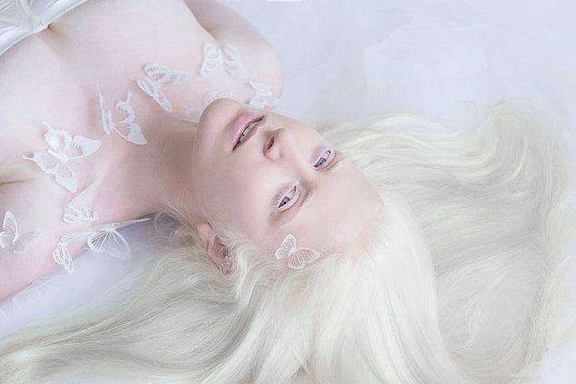 Yulia, albinizimin güzelliğinin onu hipnotize ettiğini söylüyor.