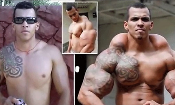 9. Ромарио Дос Сантос Алвес - вкалывает себе в мышцы масло