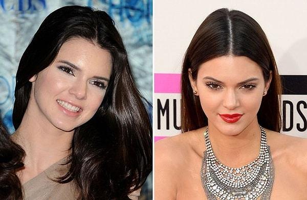 Tek fark onun kardeşi Kylie Jenner gibi abartmadan, doğal güzelliğini koruyarak değişmesiydi.