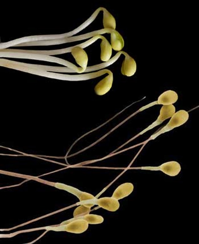 16. Soy buds and sperm as the next set of twins!