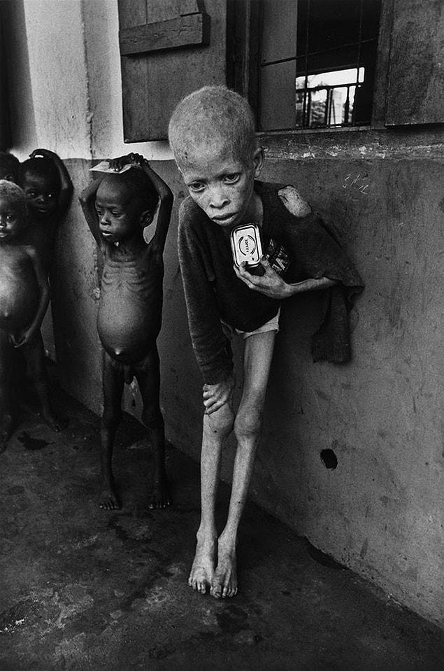 14. Albino Boy, Biafra, Don Mccullin, 1969