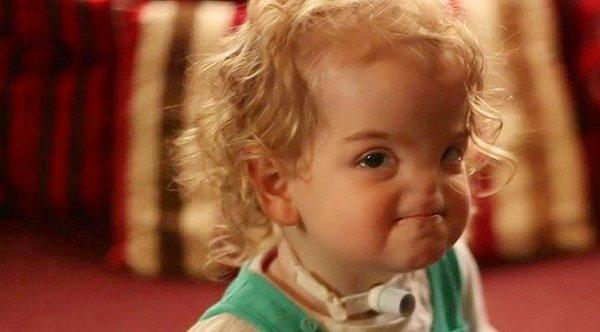 3. 2 yaşındaki Tessa Evans, doğuştan gelen bir yüz anomalisine sahip