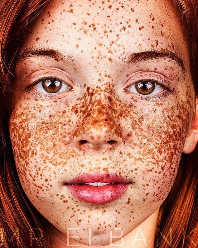 10. And this creates freckles, while making the existing ones darker.