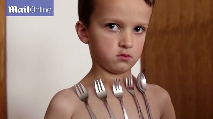 Objelerini Vücudunda Taşıyabilen 'Mıknatıs' Çocuk