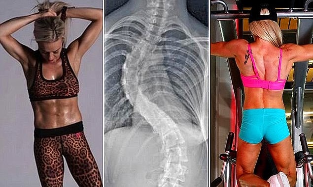 5. Doktorların 'Tekerlekli Sandalyeye Bağlı Kalacaksın!' Demesine Rağmen Spor Eğitmeni Olan Kadın